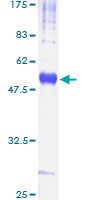 12.5% SDS-PAGE Stained with Coomassie Blue.